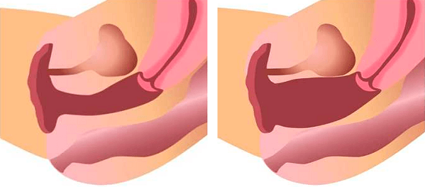 Строение женских половых органов